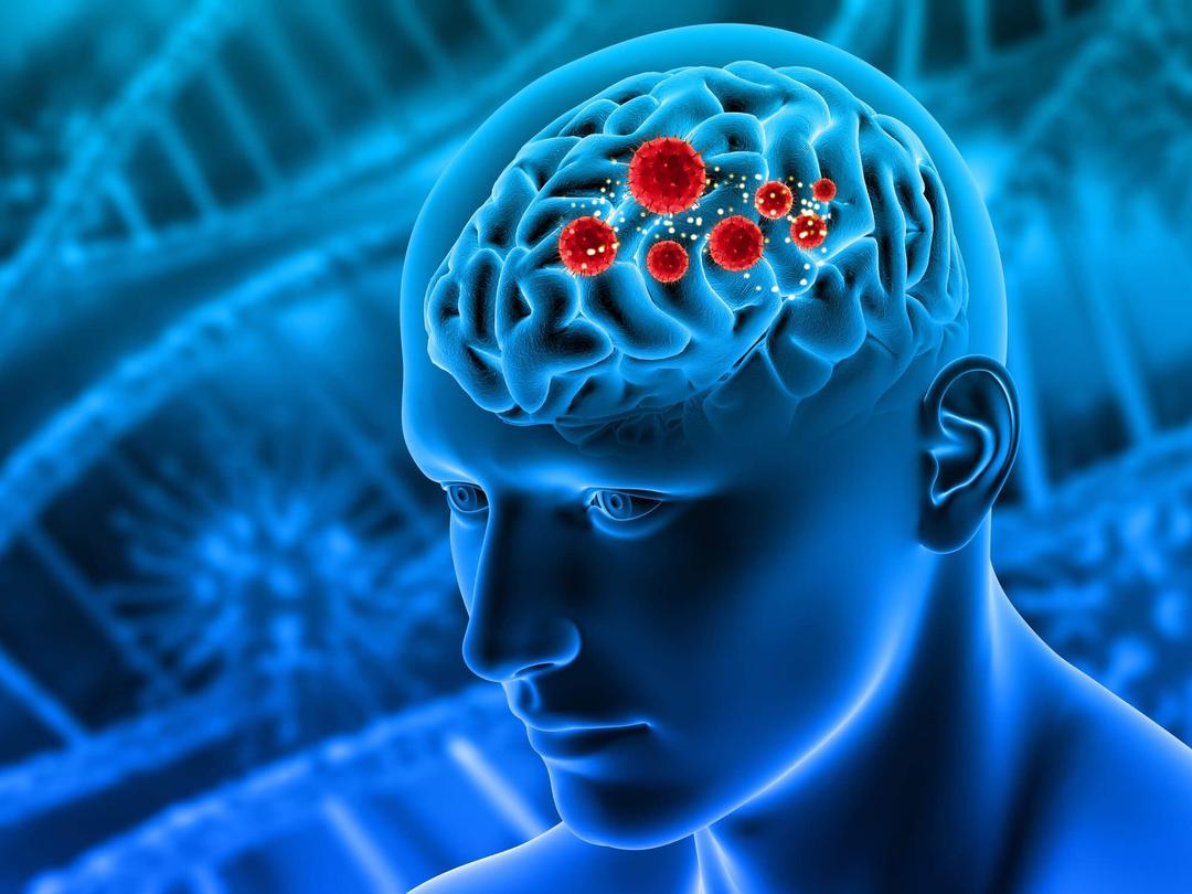 Brain tumor ke lakshan in Hindi